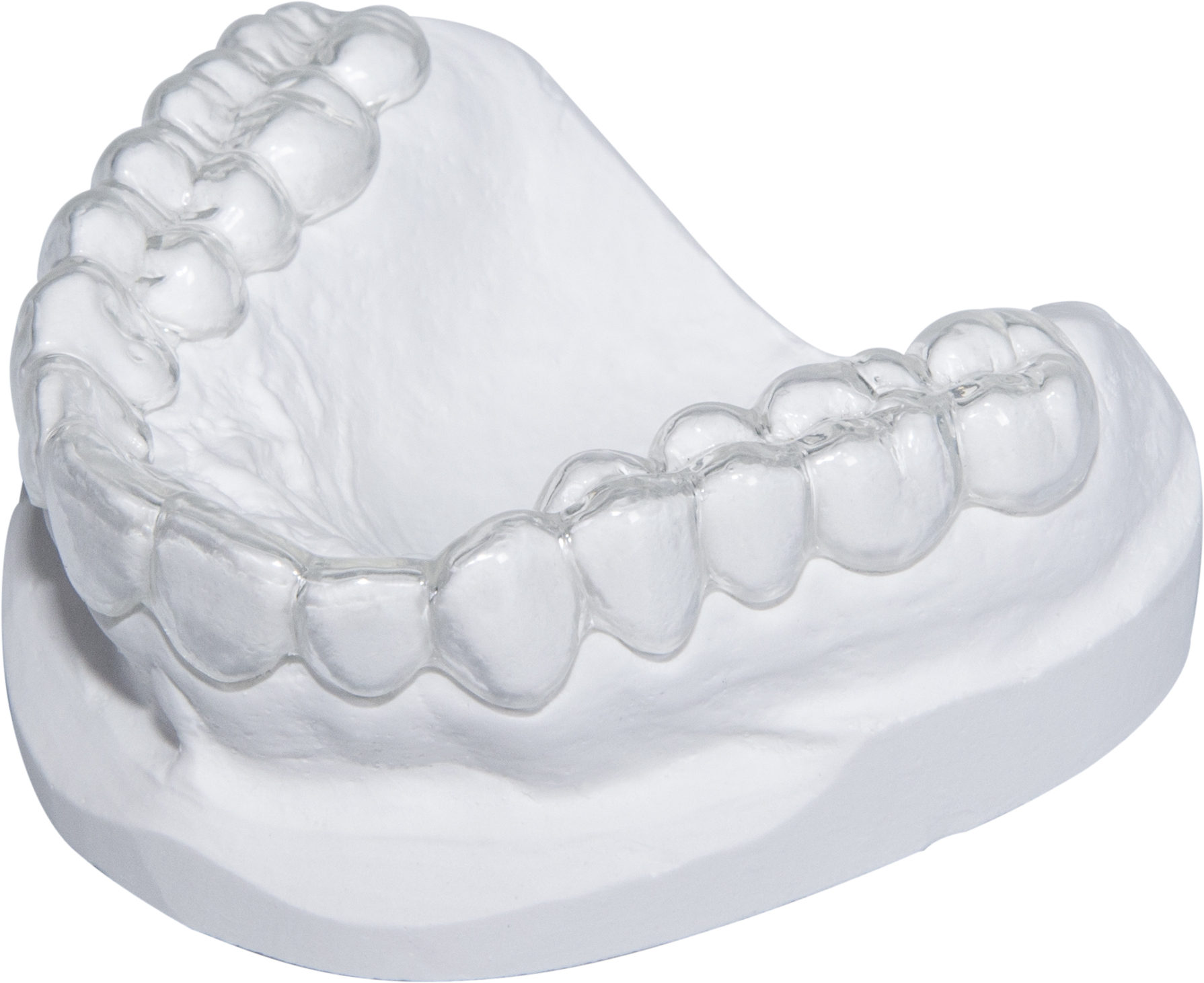 Occlusal Splints - Hard/Soft