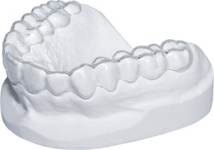 Occlusal Splints - Hard