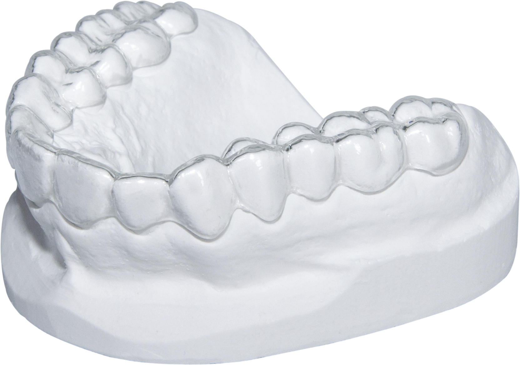 Occlusal Splints - Hard