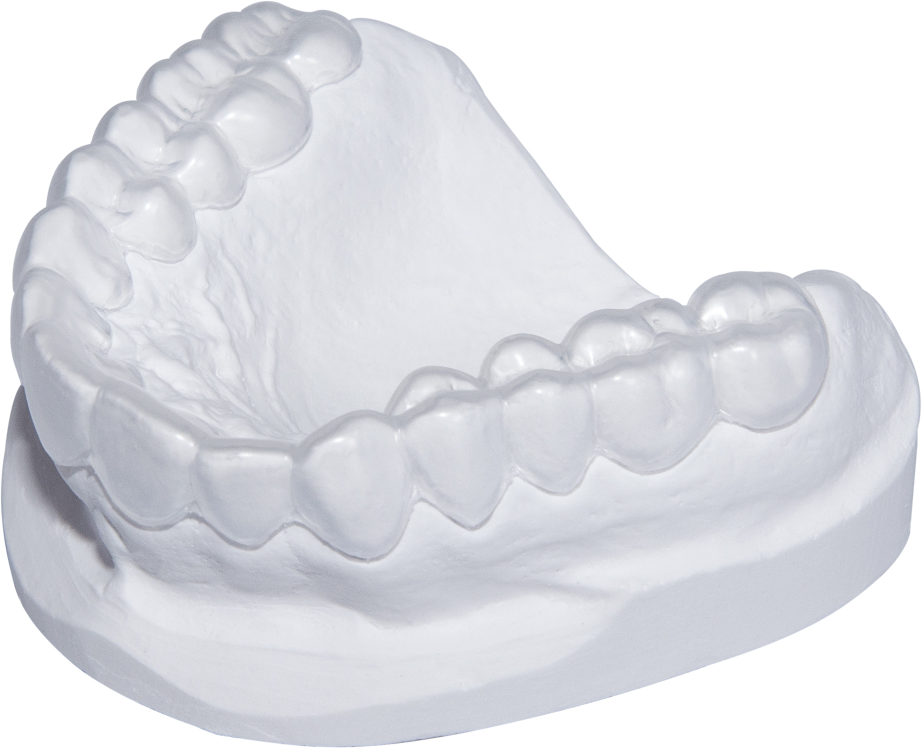 Aligners