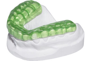 Occlusal Splints - Hard/Soft